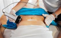 5 Sessões de Radiofrequência + 5 Sessões de Crioterapia por 79,90€ na Av. 5 de Outubro!