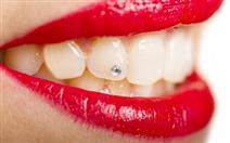 Aplicação de Piercing Dentário por 19€ em Campo de Ourique!