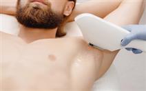 Depilação a Laser ao Corpo Inteiro para Homem por 49,90€ na Amadora!