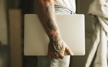 Remoção da Tatuagem com Laser por 35€ em Oeiras!